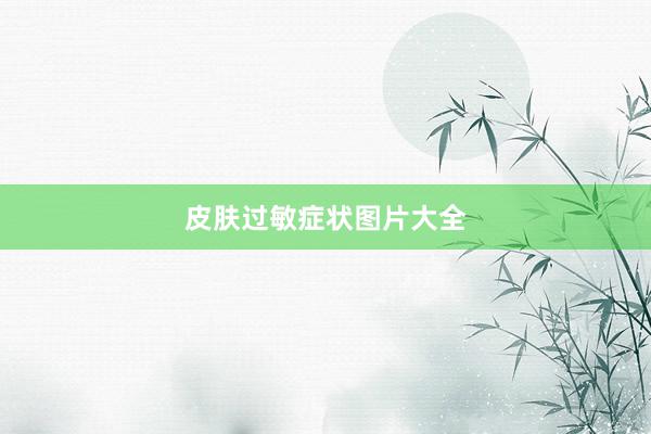 皮肤过敏症状图片大全